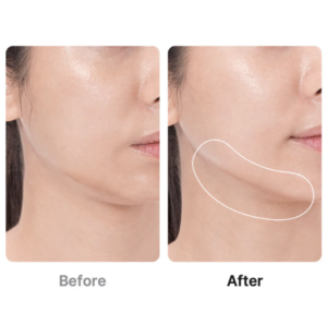 Medicube Age-R Booster Pro Pink 6‑in1